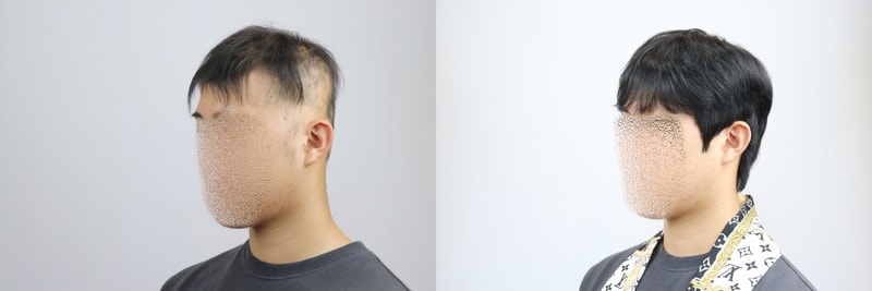 [크기변환]전체가발 2.jpg