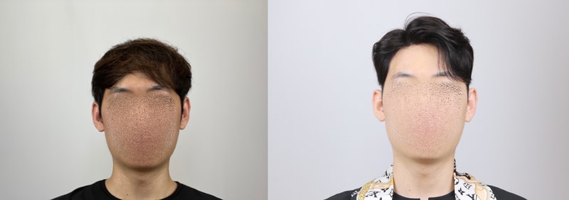 가발 1-horz.jpg