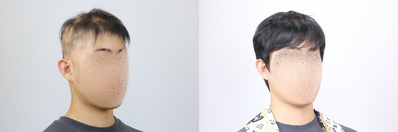 [크기변환]전체가발 8.jpg