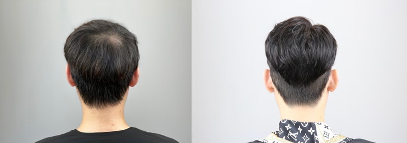 가발 5-horz.jpg