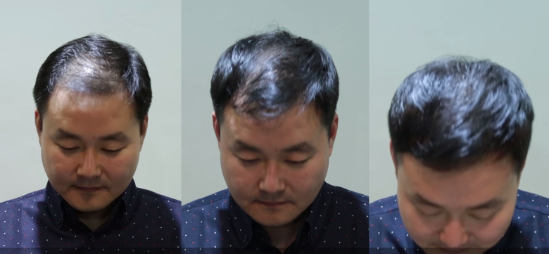 대다모44.PNG