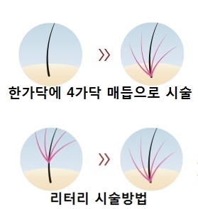 시술사진.jpg