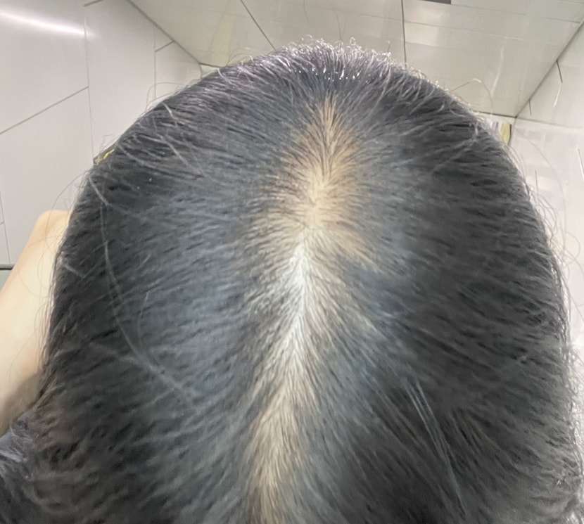 치료받기 전