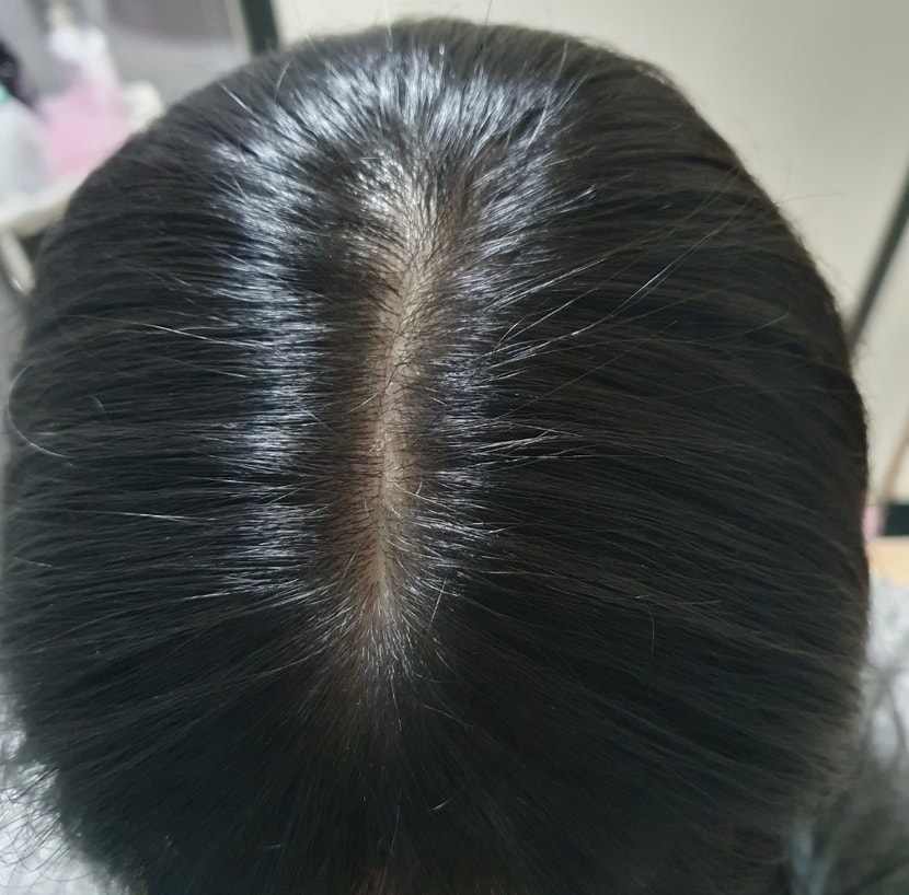 로게인폼 후 