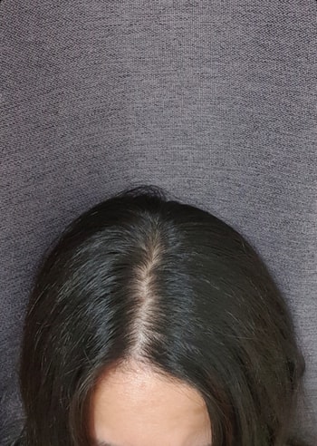 후