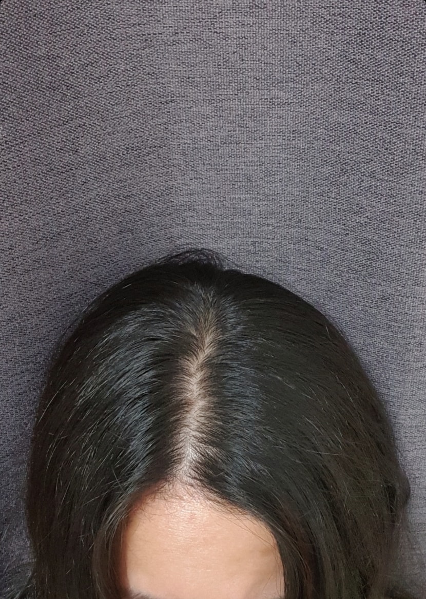 후