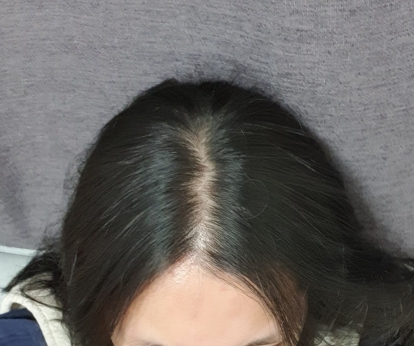 전 