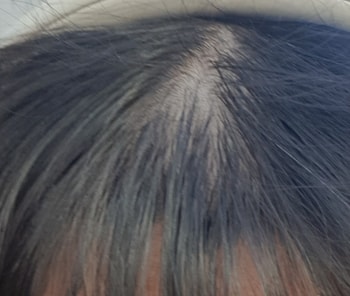 머리 안감고 떡지면 이렇게 되요