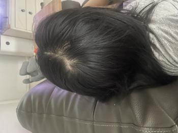 뒷가마