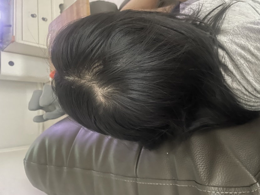 뒷가마