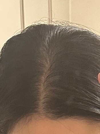 관리 후 1주일차 