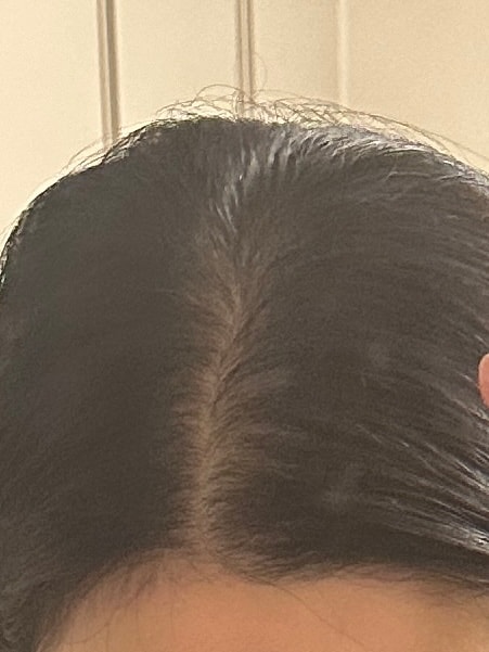 관리 후 1주일차 