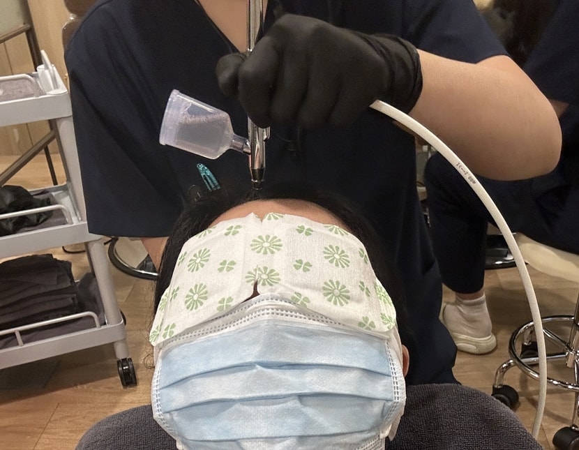 스케일링젤 도포