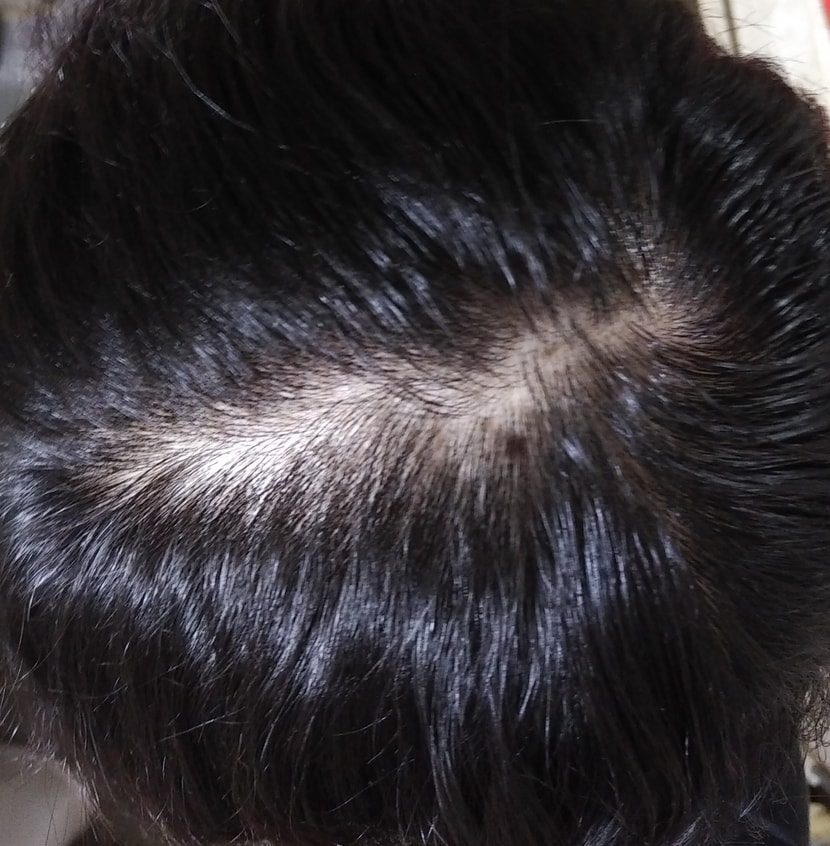 처음치료 시작할때