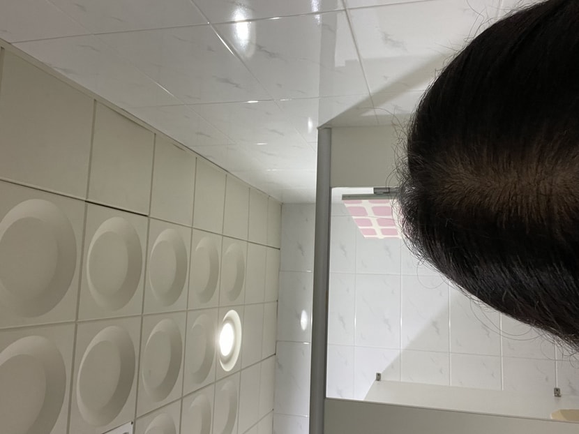 어두운 곳에서 정수리