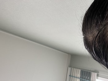 조금씩 잔머리가 올라오고 있다 ..! ????