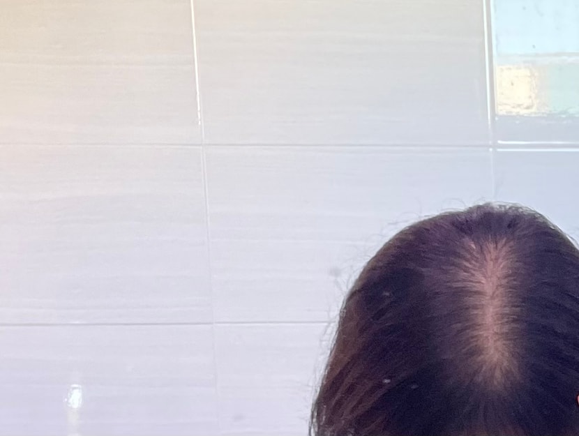 화장실 거울에서 찍은 정수리 사진 