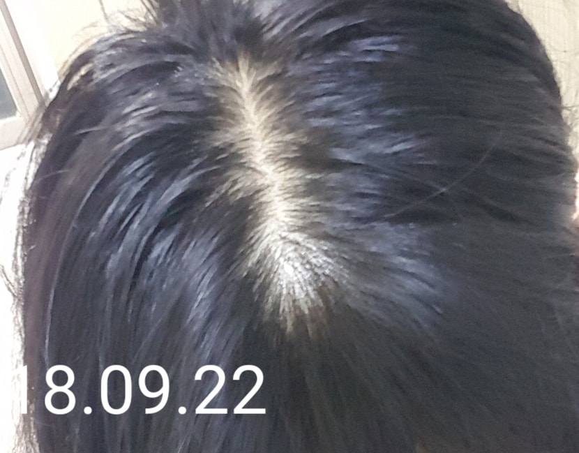 드디어 효과보이기 시작