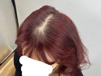 비포