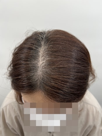 1차 에프터