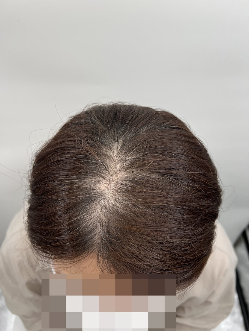 어디 지하철에 앉아 있으면 진짜 신경 쓰였어요;;;