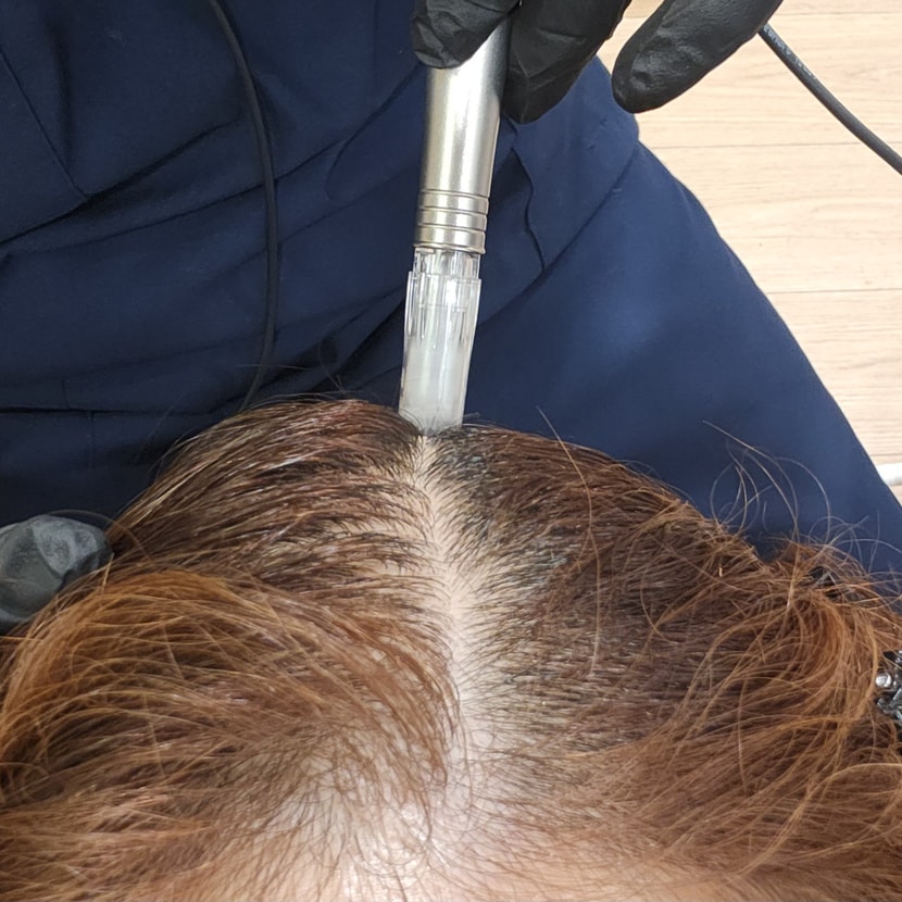 체크 주사입니다