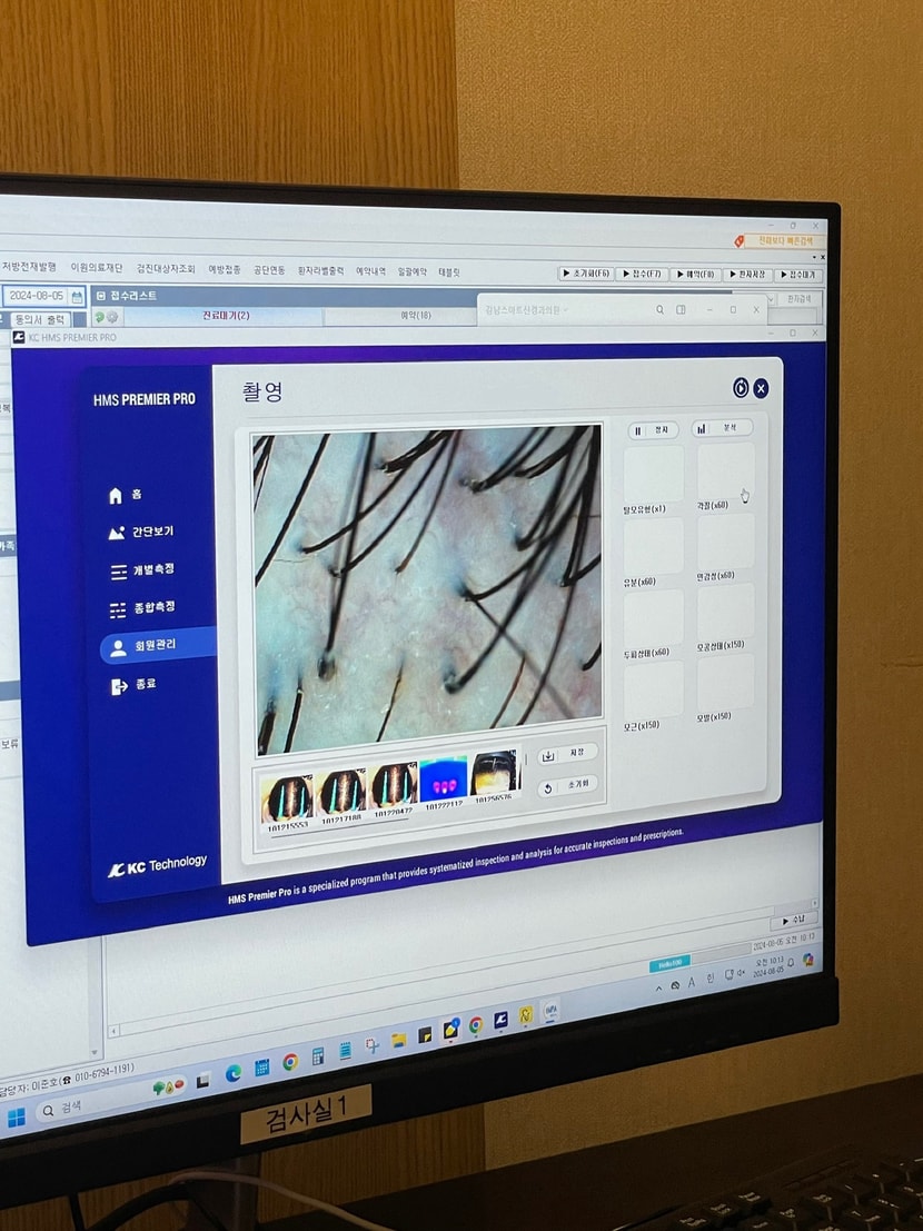 두피 모발 상태 체크