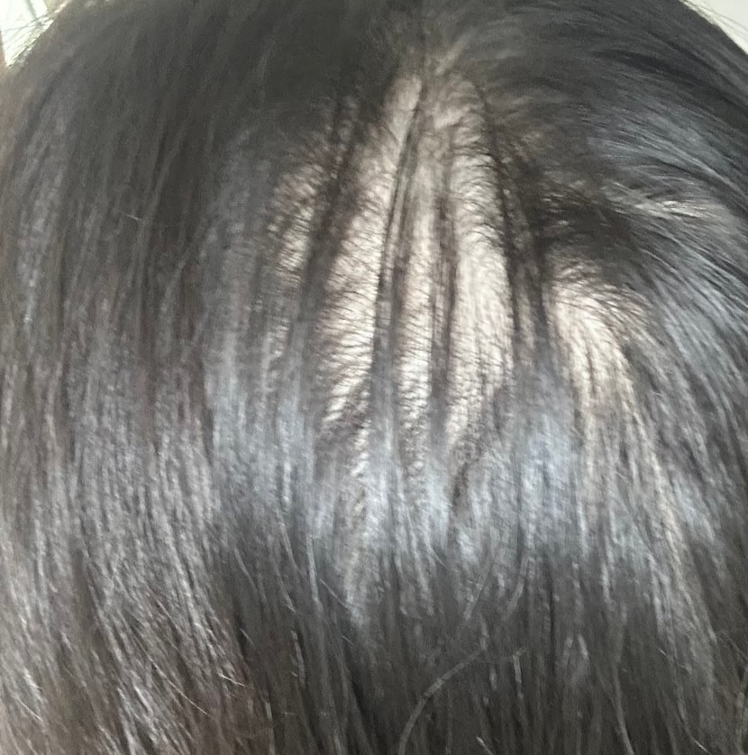 뒷통수
