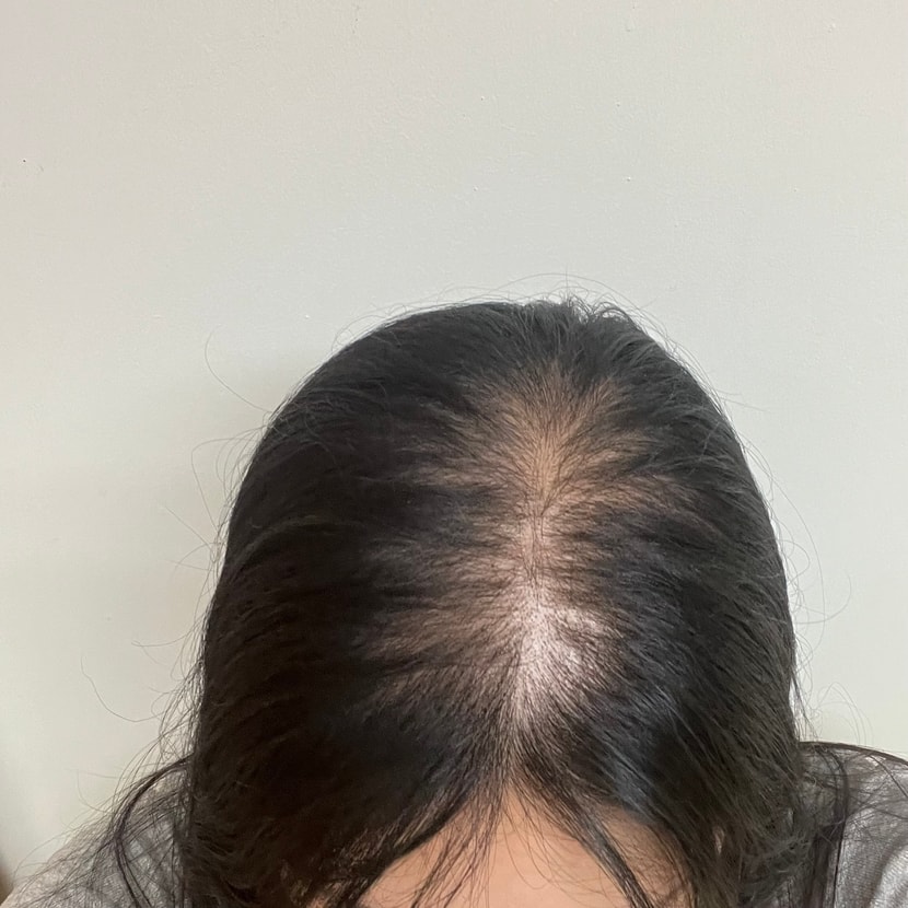 시술 전 원래 머리 상태
