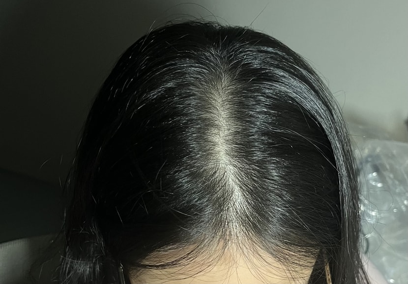 최근