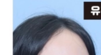 1년 전 