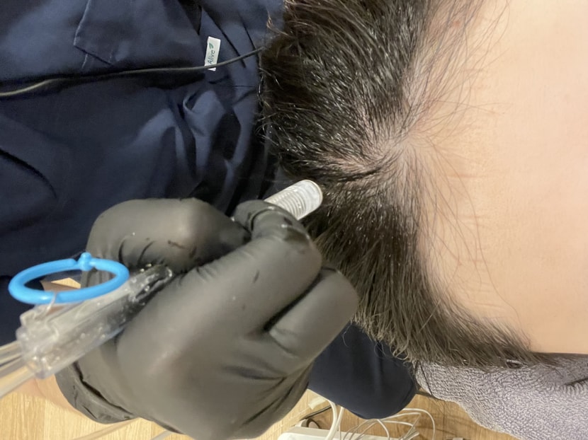 3) 산소 제트필  이제 불린 묵은 각질들을 수압으로 촤라락 ~  이것도 너무 시원했어요 ,, 선생님 완전 꼼꼼하게 해주셔서  진짜 뇌를 갈아끼운 그런 시원함 ! ㅋㅋㅋ  