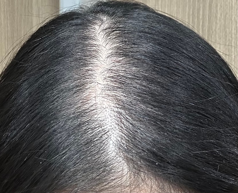 조명밑에서 정수리 찍었을때