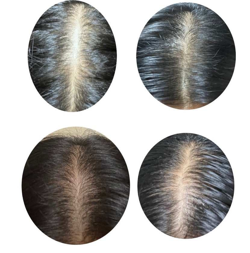 초반(대략..몇달전)