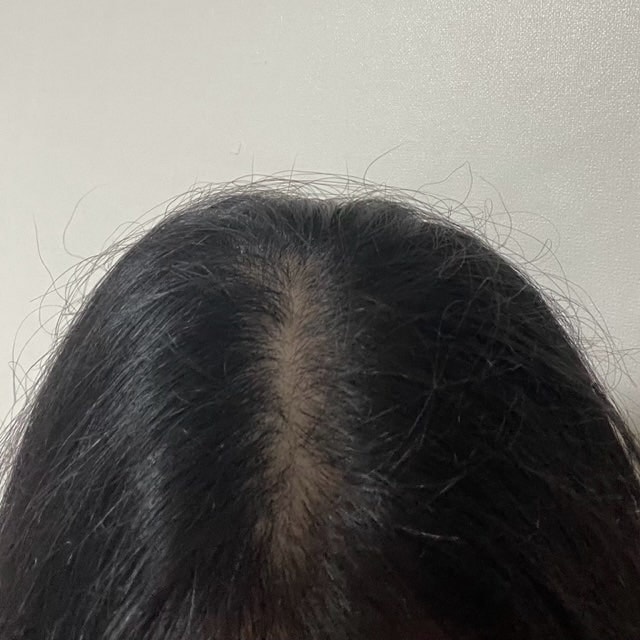 치료 중