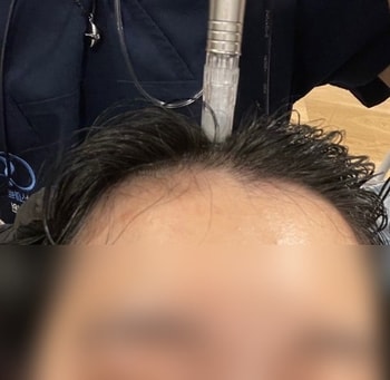 산소제트필