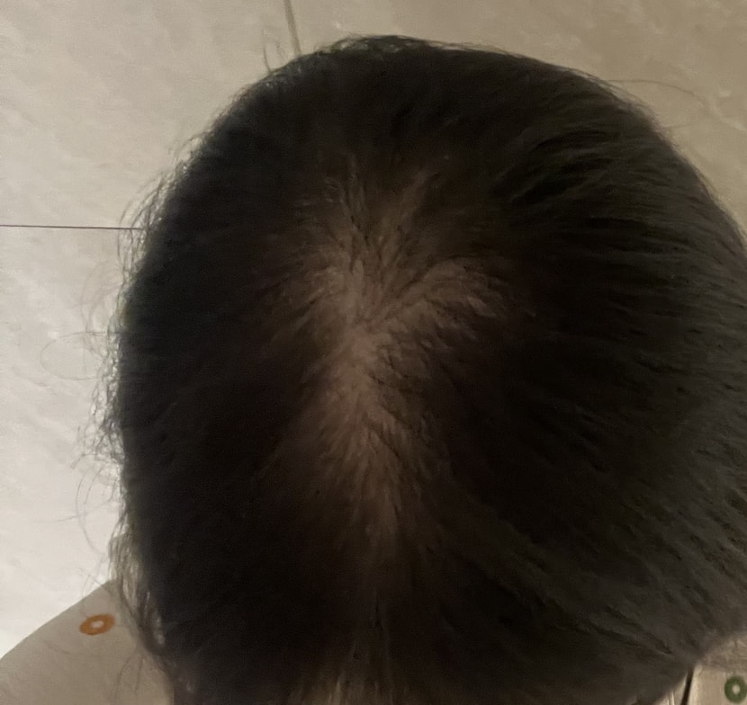 조명x