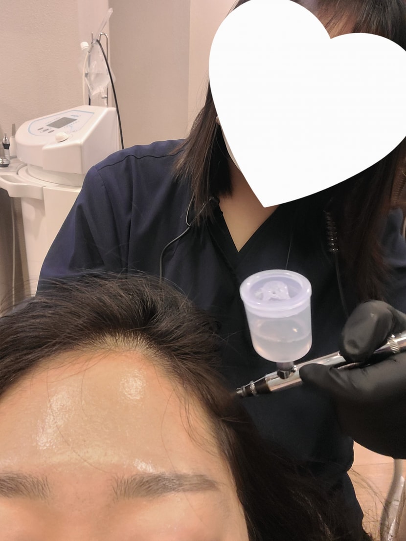 두피 스케일링을 먼저 시작합니다 너무 시원해서 좋아요 각질 탈탈 털리는 느낌