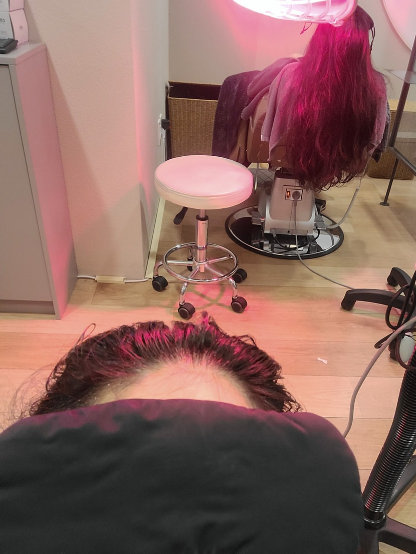 적외선 치료도 같이 진행하구요 두피 진정되는 느낌이에요