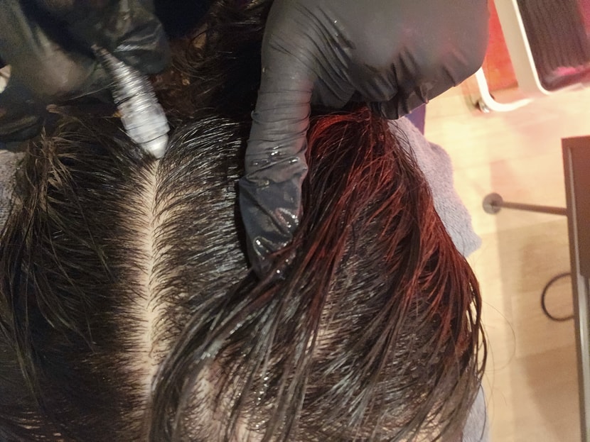 모낭강화 체크 주사!