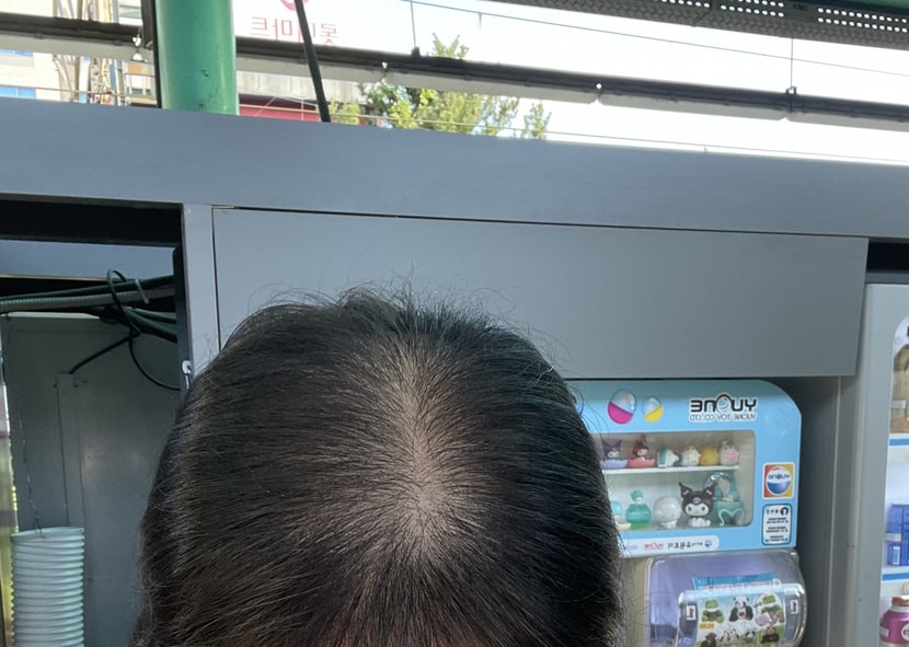 조금씩 채워지는 중입니다!