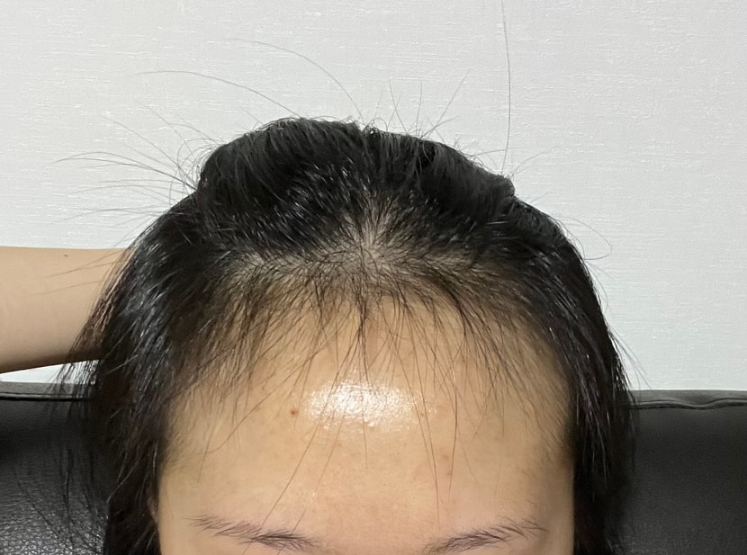 이마