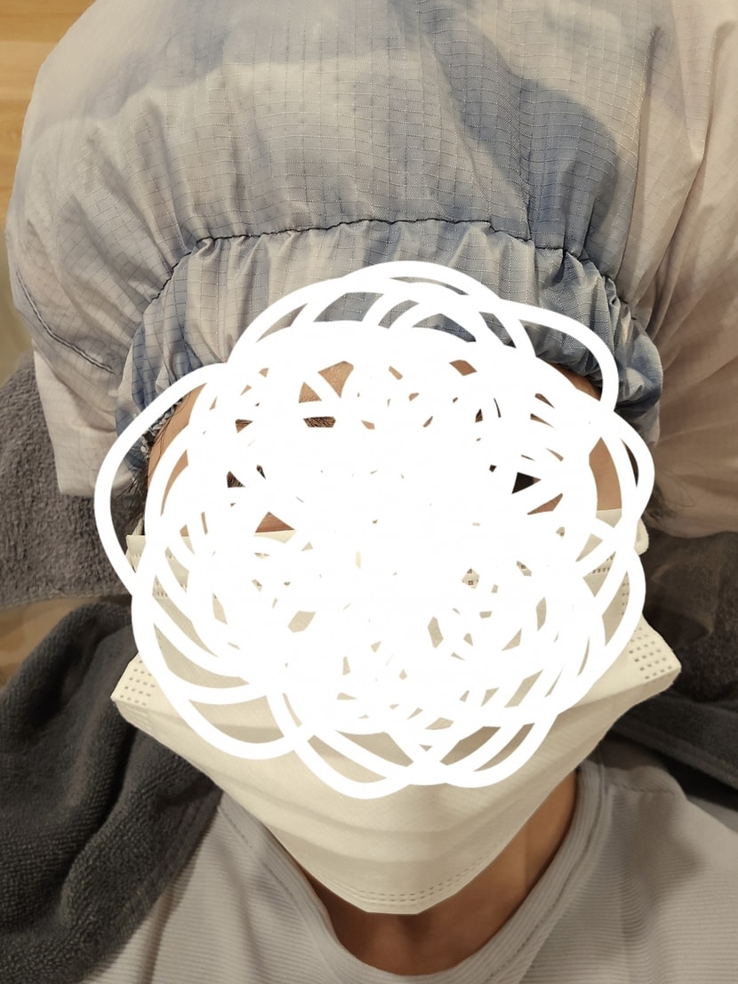 스팀처리하여 각질을 불림