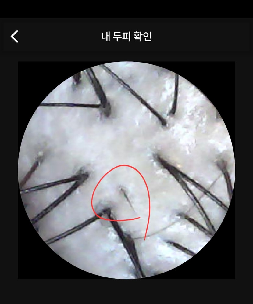 3주 후 두피상태