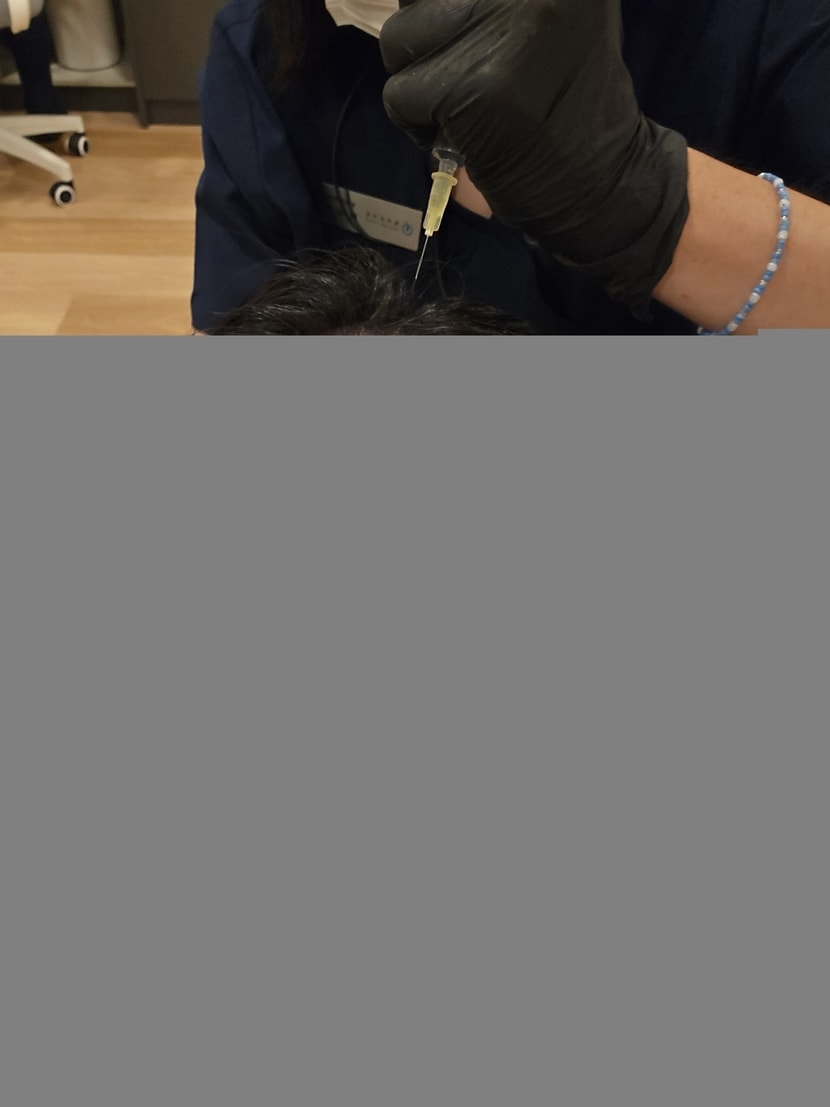 주사기로 찌르는건 아니고 앰플을 두피에 뿌리고 손으로 문질러서 흡수시켜줌