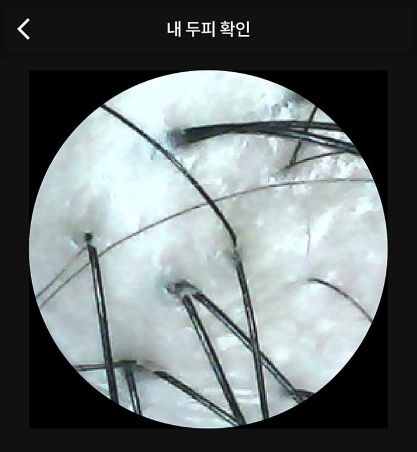 관리전 두피상태