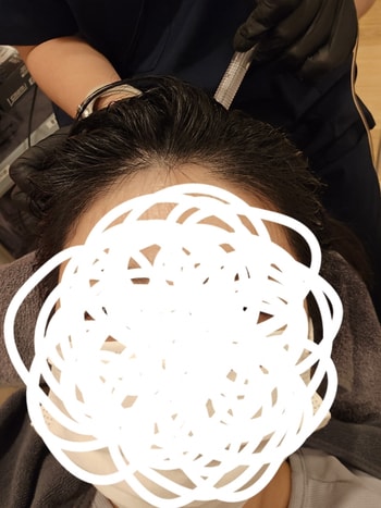 공기압으로 각질제거