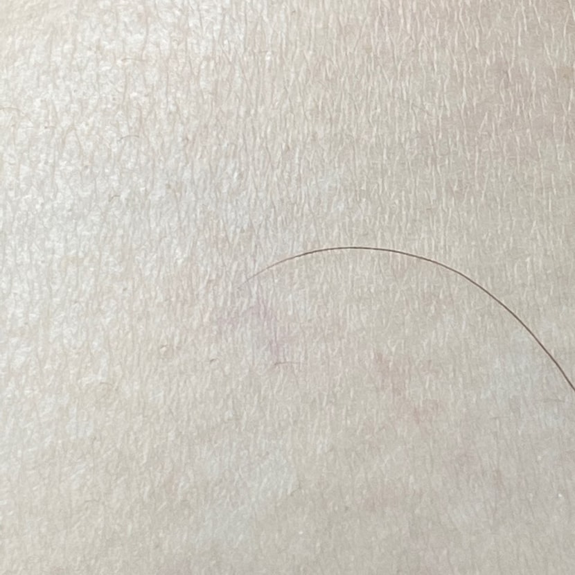 2020년 6월 모발 끝이에요. 모근으로 갈수록 얇아졌어요.