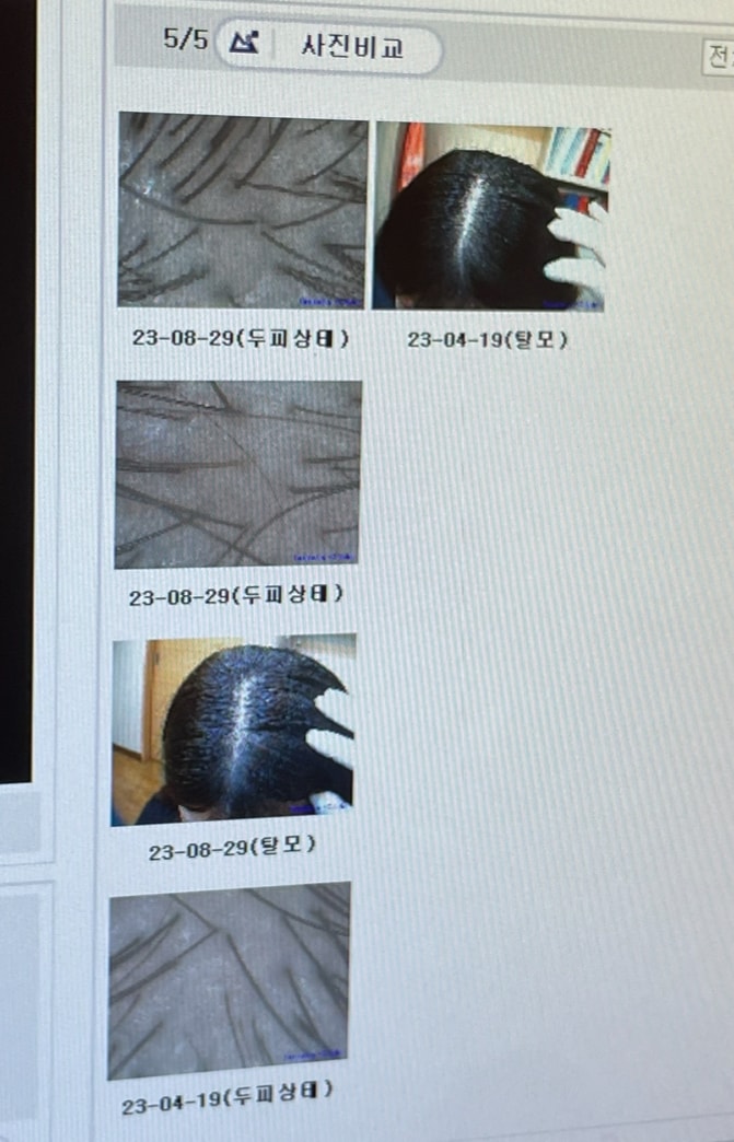 병원 현미경사진