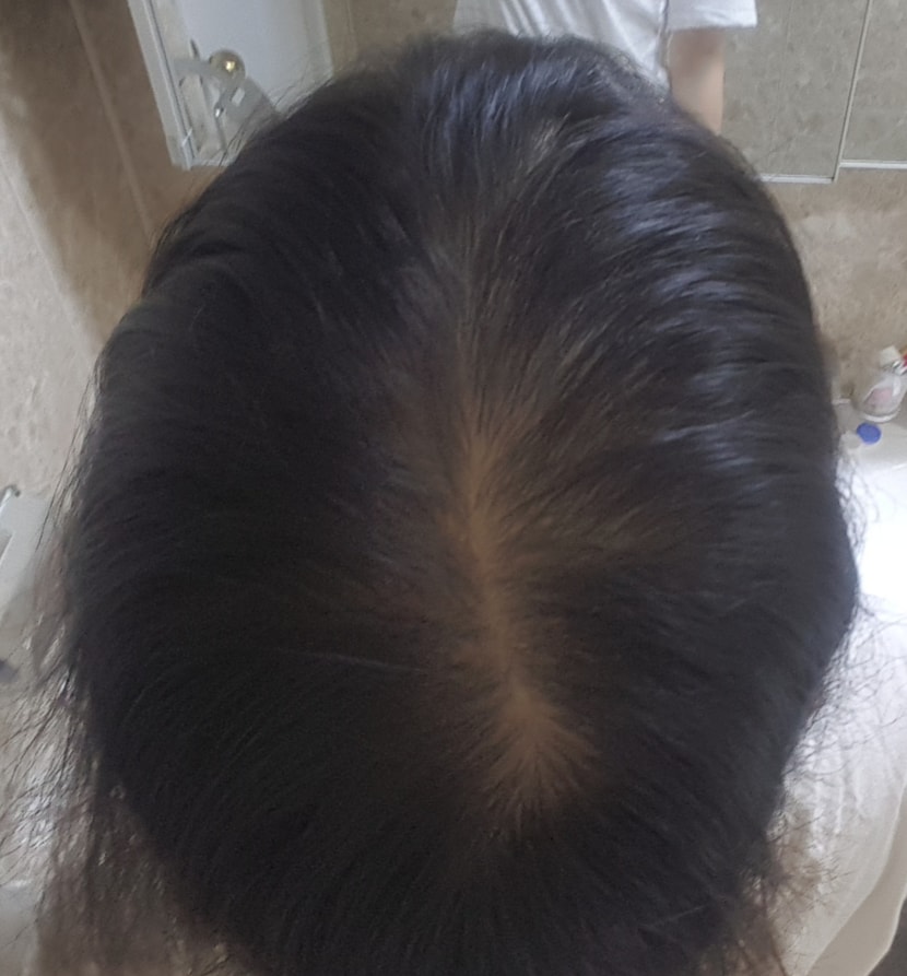 바른 후